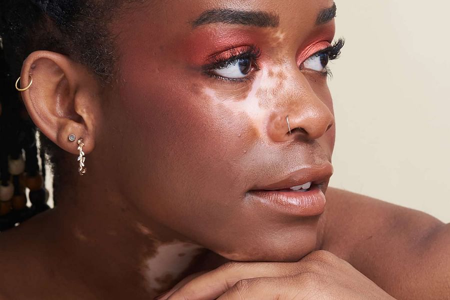 Karen people ear gauges