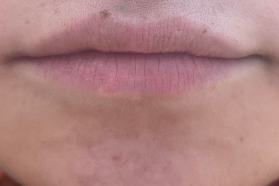 lip piercing variations