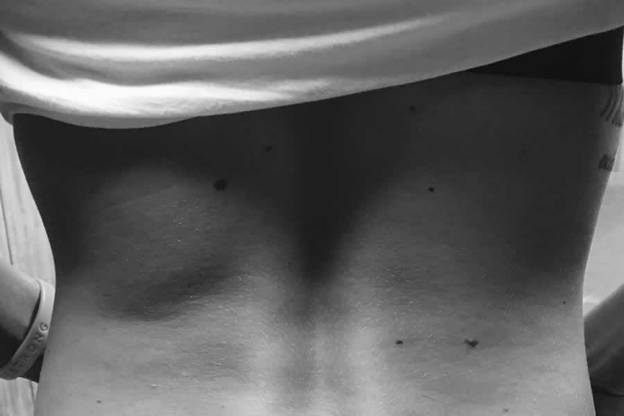 back dimple dermal piercing