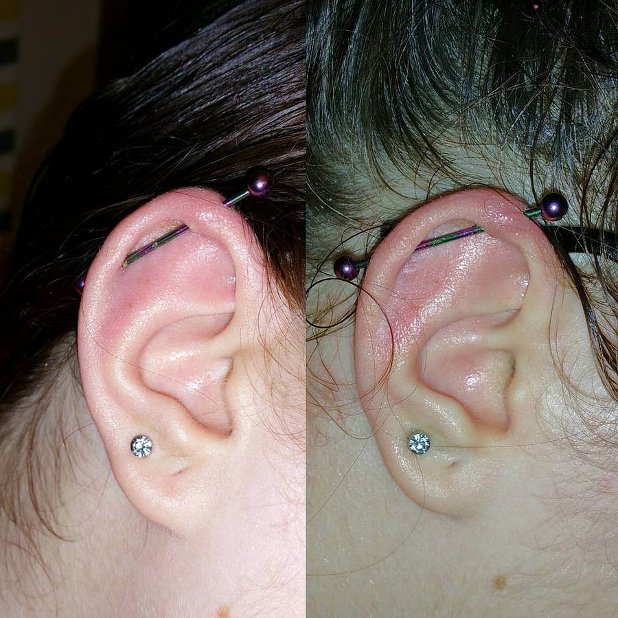 Ear Piercing Healing Timeline What to Expect and How to Speed Up Recovery