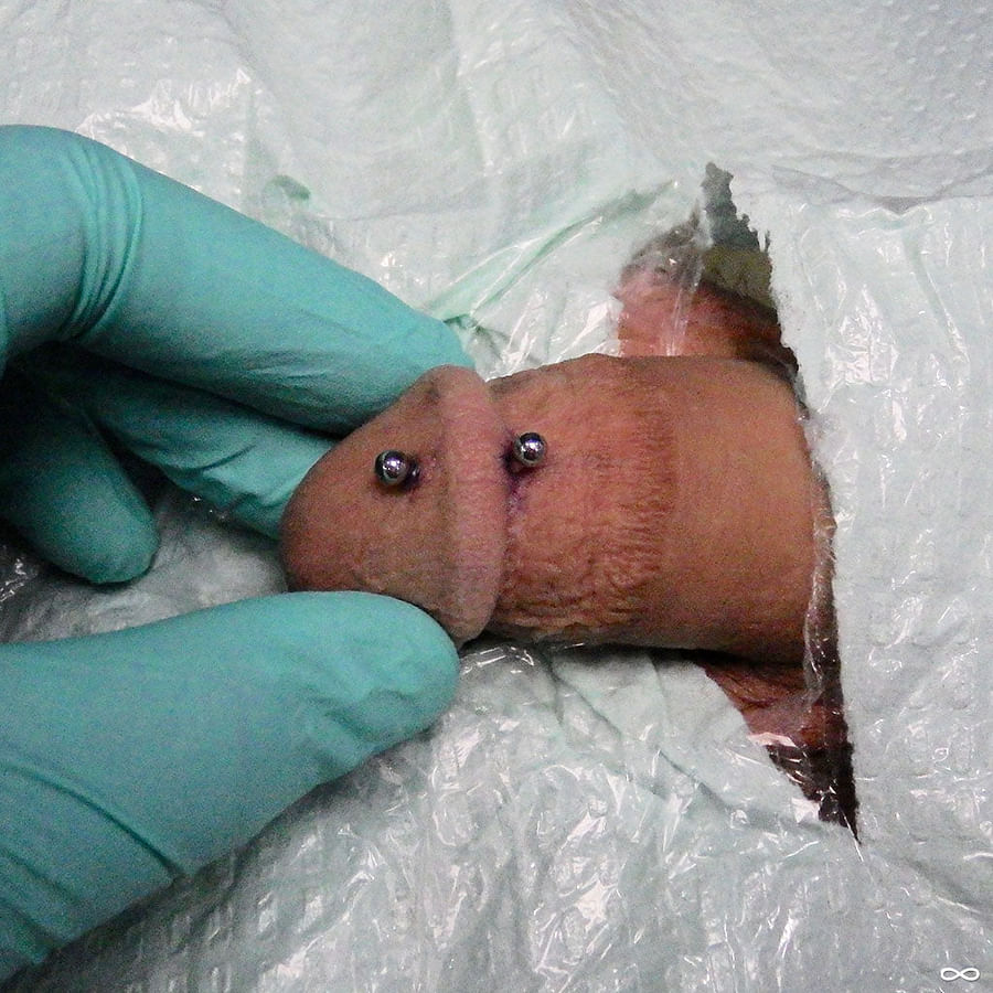 Illustration showing potential risks and complications of double dydoe piercing